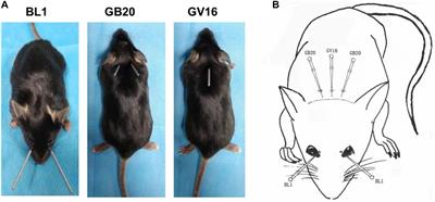 Acupuncture Treatment Reverses Retinal Gene Expression Induced by Optic Nerve Injury via RNA Sequencing Analysis